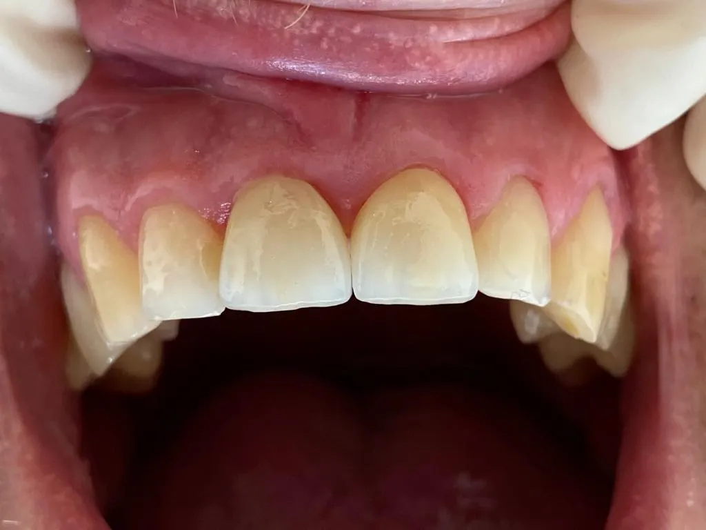 Ihr Zahn ist uns wichtig! Zahnheilkunde in Eimsbüttel